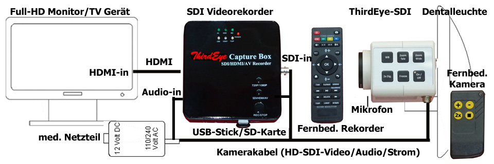 System Thirdeye SDI Rekorder Monitor